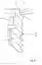 Fig. 03 - Dental implant