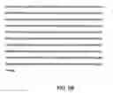 Fig. 07 - CACNB2 nucleic acid mutations as indicators of shorter than normal QT interval and ST segment elevation associated with sudden cardiac death
