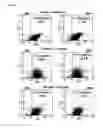 Fig. 08 - One step nanosensor for single and multidrug resistance in acute coronary syndrome (ACS)