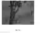 Fig. 02 - Methods and compositions for detection of lethal cell and uses thereof
