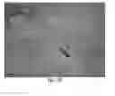 Fig. 03 - Methods and compositions for detection of lethal cell and uses thereof