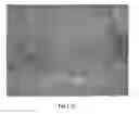 Fig. 04 - Methods and compositions for detection of lethal cell and uses thereof