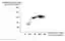 Fig. 01 - Blood analyzer, blood analysis method and hemolytic agent