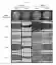 Fig. 03 - METHODS OF FABRICATING ENHANCED TISSUE-ENGINEERED CARTILAGE