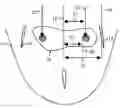 Fig. 01 - System for Fin Placement on Surfboards