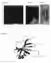 Fig. 02 - Modified Stefin A scaffold proteins