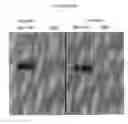 Fig. 09 - Modified Stefin A scaffold proteins