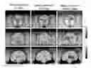 Fig. 01 - METHODS TO REDUCE THE EFFECTS OF SLEEP DEPRIVATION