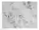 Fig. 01 - MicroRNA-Based Methods and Compositions for the Diagnosis, Prognosis and Treatment of Prostate Related Disorders