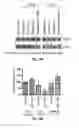 Fig. 04 - MicroRNA-Based Methods and Compositions for the Diagnosis, Prognosis and Treatment of Prostate Related Disorders