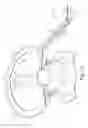 Fig. 09 - Penile prosthesis cap, assembly, and implantation tool