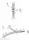 Fig. 04 - Minimally invasive retractor and methods of use