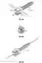Fig. 11 - Minimally invasive retractor and methods of use