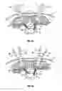 Fig. 15 - Minimally invasive retractor and methods of use