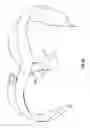 Fig. 16 - Minimally invasive retractor and methods of use