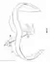Fig. 17 - Minimally invasive retractor and methods of use
