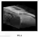 Fig. 05 - SYSTEM FOR PHOTOACOUSTIC IMAGING AND RELATED METHODS