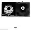 Fig. 07 - Tissue Scanner