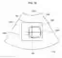 Fig. 09 - Setting an optimal image parameter in an ultrasound system