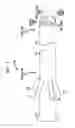 Fig. 02 - DIRECT VISUALIZATION CATHETER