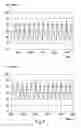 Fig. 07 - Blood pressure measuring device and method for measuring the blood pressure of a living being