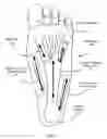 Fig. 02 - Foot pain relief device