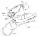 Fig. 01 - Biliary shunts, delivery systems, and methods of using the same