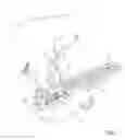 Fig. 02 - Biliary shunts, delivery systems, and methods of using the same