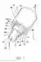 Fig. 02 - Hemostasis valve with iris seal