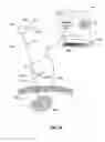 Fig. 07 - Ecogenic Cooled Microwave Ablation Antenna