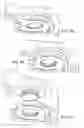 Fig. 14 - Device and method for deploying and attaching an implant to a biological tissue