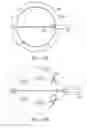 Fig. 34 - Device and method for deploying and attaching an implant to a biological tissue