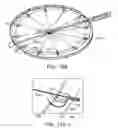 Fig. 36 - Device and method for deploying and attaching an implant to a biological tissue
