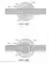Fig. 41 - Device and method for deploying and attaching an implant to a biological tissue