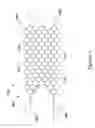 Fig. 19 - RECANALIZATION DEVICE WITH EXPANDABLE CAGE