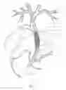 Fig. 04 - Occlusion device