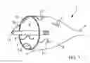 Fig. 02 - EMBOLIC PROTECTION METHOD