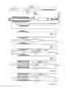 Fig. 03 - EMBOLIC PROTECTION METHOD