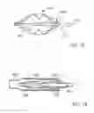 Fig. 20 - EMBOLIC PROTECTION METHOD