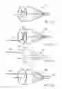 Fig. 31 - EMBOLIC PROTECTION METHOD