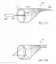Fig. 47 - EMBOLIC PROTECTION METHOD