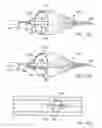 Fig. 48 - EMBOLIC PROTECTION METHOD