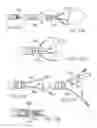 Fig. 56 - EMBOLIC PROTECTION METHOD