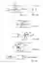 Fig. 57 - EMBOLIC PROTECTION METHOD