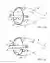 Fig. 60 - EMBOLIC PROTECTION METHOD