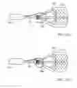 Fig. 62 - EMBOLIC PROTECTION METHOD