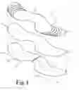 Fig. 04 - External nasal dilator and methods of manufacture
