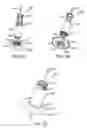 Fig. 06 - Burr hole sealing device for preventing brain shift