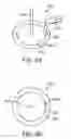 Fig. 10 - Burr hole sealing device for preventing brain shift