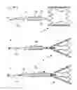 Fig. 12 - Device for closing defects in the vascular system